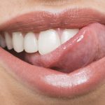 A fogorvosok szerint ez a népszerű ital károsíthatja a leginkább a fogakat