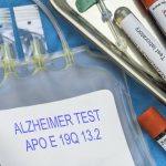 Az Alzheimer-kór a 3-as típusú cukorbetegség?